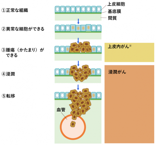 がんの発生と進行