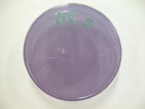 BCPﾌﾟﾚｰﾄｶｳﾝﾄ培地(接種前）